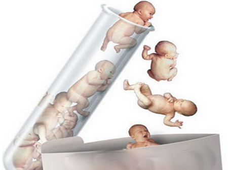 体外受精 IVF-ET